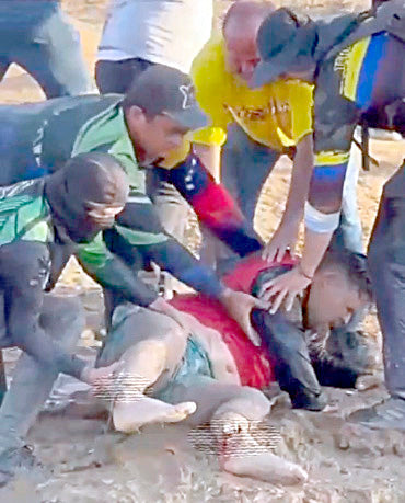 Hombre casi pierde ambos pies en accidente durante evento rústico en Anzoátegui